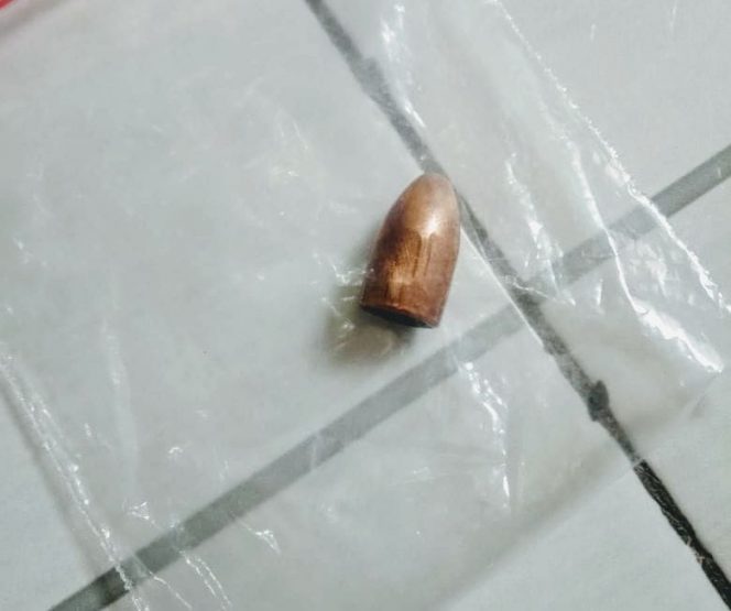 
 Satu butir peluru yang menyasar kepaha salah satu pelajar di Palangkaraya. (FOTO: Dokumen Ist).